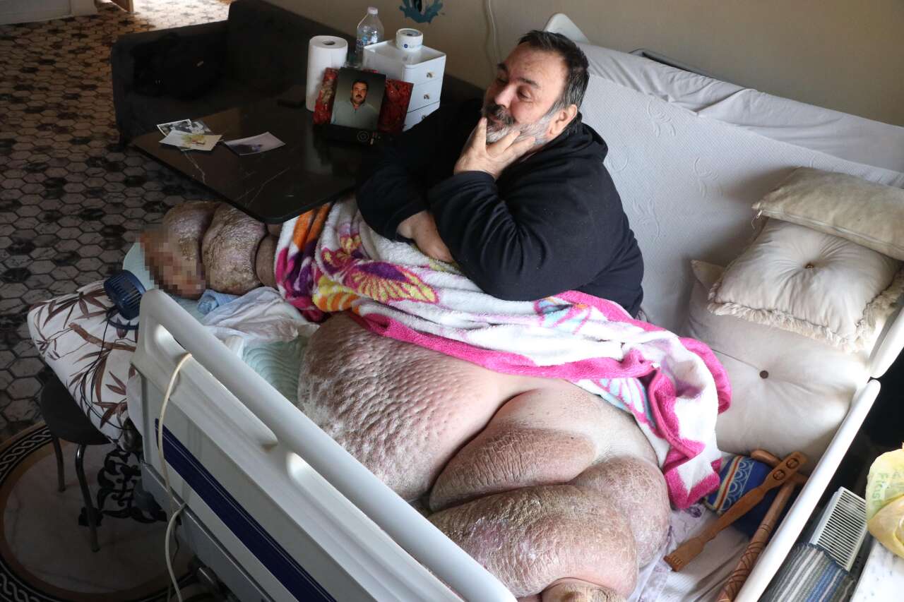 300 kiloluk hayata sıkıştı, 5 yıldır dört duvar arasında 1